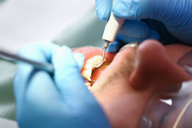 Best Holiday Emergency Dentist in Jenison, MI