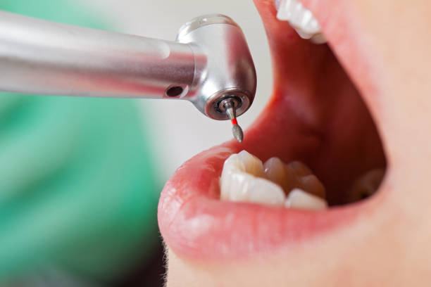 Best Weekend Emergency Dentist in Jenison, MI
